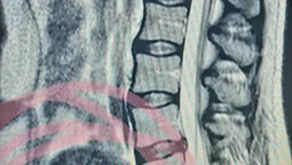 2/5 Diagnose dagboek: ... of speelt er meer dan alleen MS?