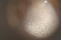 wax-ear.jpg