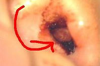 symptoms0126.jpg