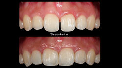 LINE_ALBUM_ทพ.พิภพ_250830_3