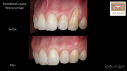 LINE_ALBUM_ทพ.กฤตวัฒน์_250830_3