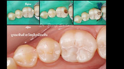 LINE_ALBUM_ทพ.พิภพ_250830_2