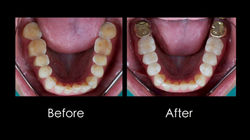 LINE_ALBUM_รศ.ทพ.เฉลิมพล_250908_3