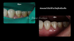 LINE_ALBUM_ทพ.พิภพ_250830_4