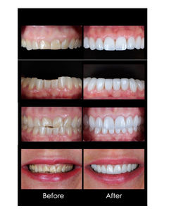 LINE_ALBUM_รศ.ทพ.เฉลิมพล_250908_1