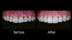 LINE_ALBUM_รศ.ทพ.เฉลิมพล_250908_13