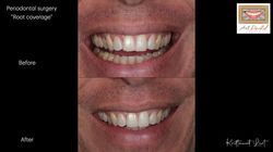 LINE_ALBUM_ทพ.กฤตวัฒน์_250830_4