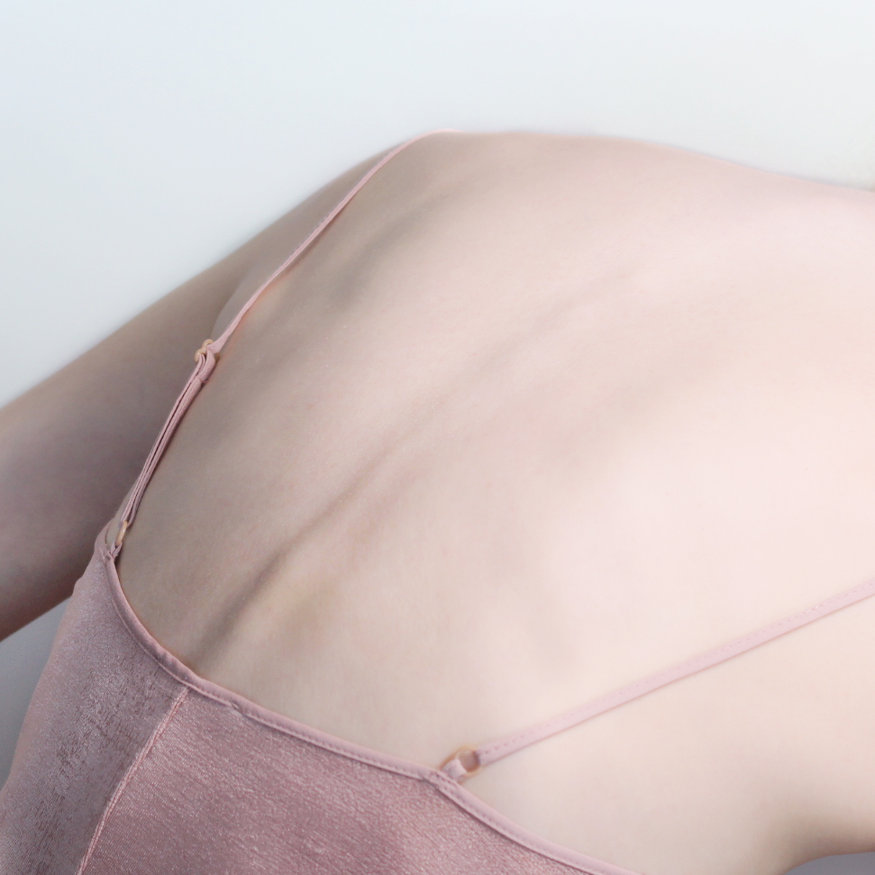 Back Pain
