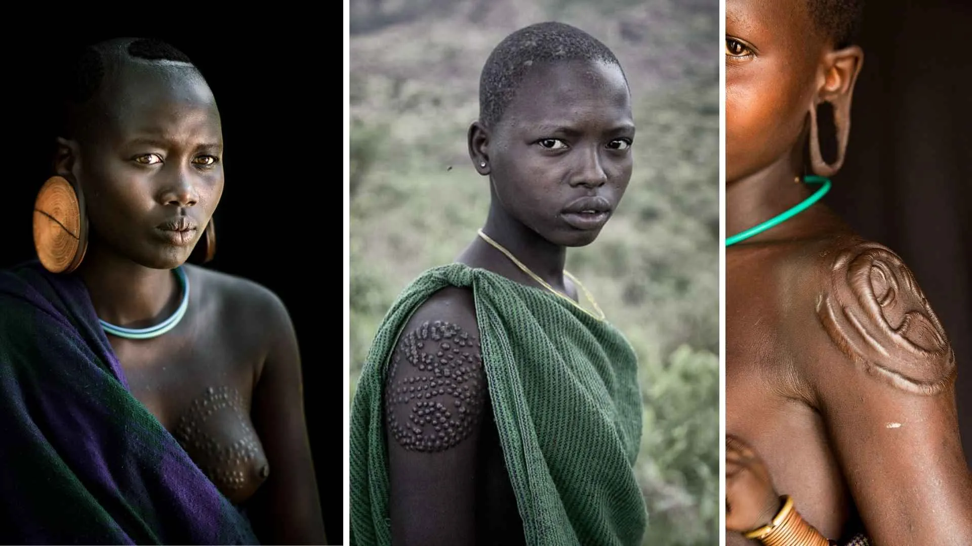 Suri beauty scars 