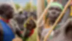 Scars earned during Suri donga (stick fighting) are traditionally worn with pride, symbolizing courage, endurance, and masculine identity. In Suri culture, these marks represent participation in a respected rite of passage rather than mere signs of injury.