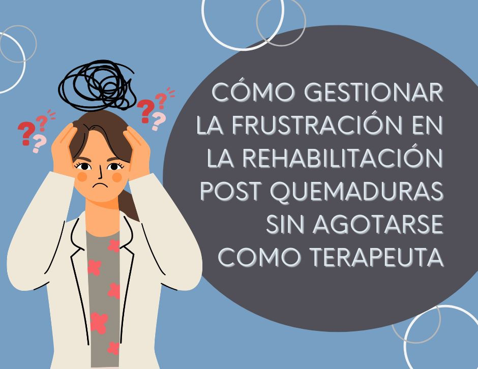 frustración en la rehabilitación post quemaduras