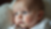 Close-up view of infant’s head showing mild asymmetry from the side