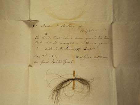 透過遺留的頭髮 DNA,解析貝多芬的疾病