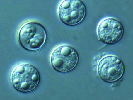 Understanding Cyclospora Through U.S. Food Contamination Events: A Parasite Hidden in the Fresh Produce Supply Chain
