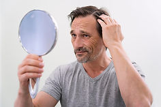 man-getting-hair-loss-treatment (1).jpg