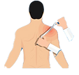 instrument-assisted-soft-tissue-mobilization-260nw-1469204933_edited_edited.png