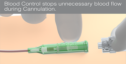 IV Cannula Additional Features_edited