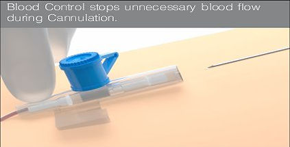 IV Cannula Additional Features_edited