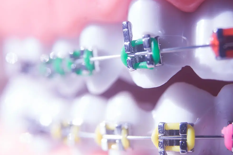 What Evolution Explains About Crowded Teeth, Say Dentists