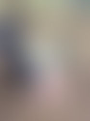 A close up of a yak's face with a bloody nose