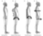 Can you recognise your posture?