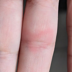 soin des chakras pour problèmes de peau