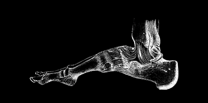 entorse do tornozelo, ligamento do tornozelo, ortopedia biologica