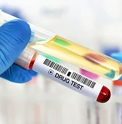 drug-test-vials_edited_edited.jpg