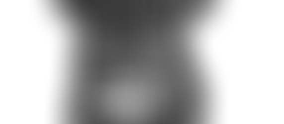 Las republiquetas de Lomitolandia y la seguridad del no nacido