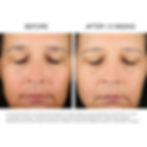 Thumbnail: Retinol Night Repair Serum