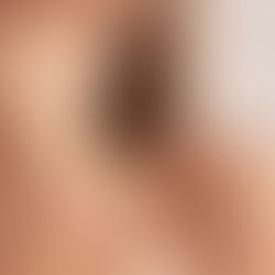 Une peau éclatante grâce à la naturopathie : Alimentation, plantes et soins naturels