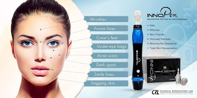 innopen microneedling calgary nw