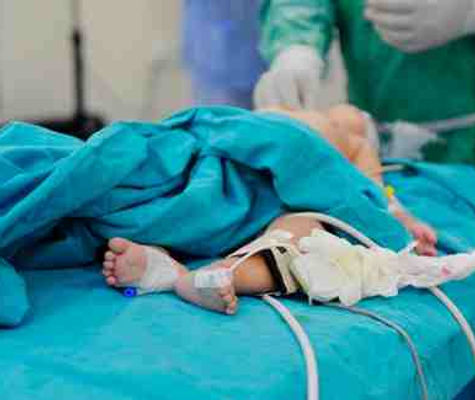 Pediatric Surgery