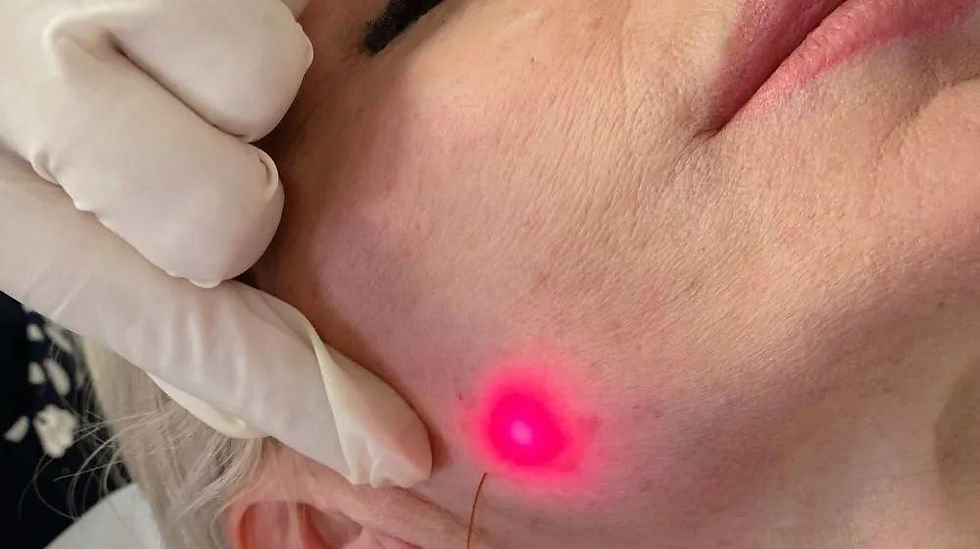 ENDOLITE LIFT: The Non-Surgical Laser Facelift Redefining Facial Contouring