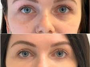 tear through  filler in  high wycombe.jpg