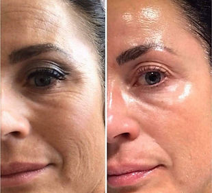 BEFORE AND AFTER ADVANCED REJUVENATION BOOSTERS PLAN.jpg