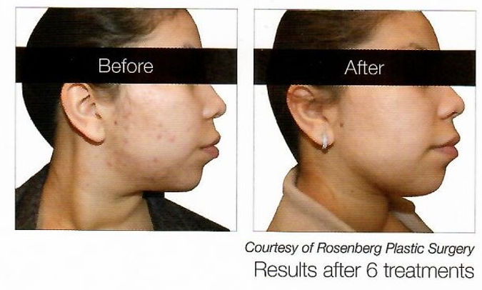 pokey results 1.jpeg