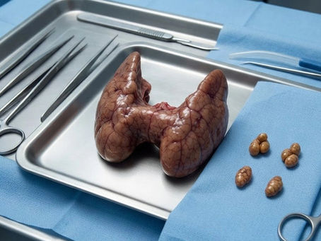 Thyroidectomy: It’s Not All About the Nerve
