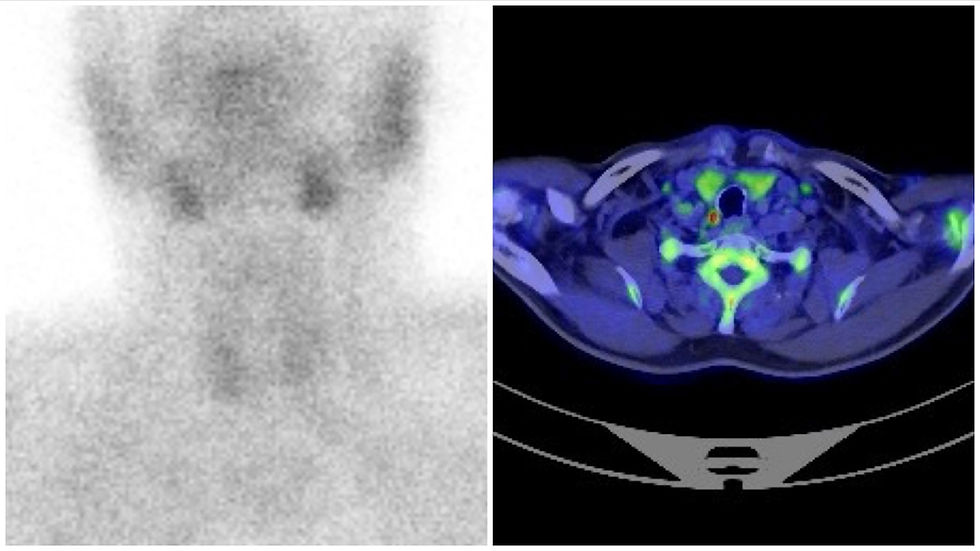 Parathyroid adenoma localization: our findings support a new first-line imaging strategy.