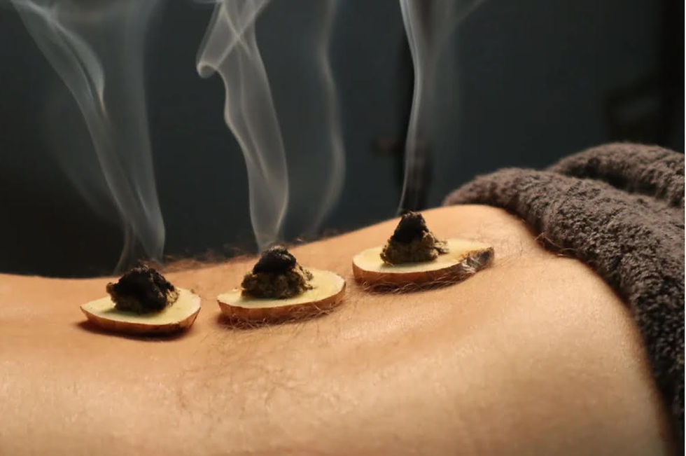 Preferm moxibustion