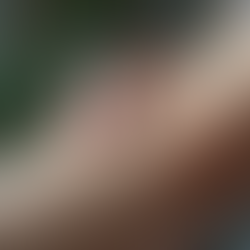 The Benefits of Acupuncture for Relieving Elbow Pain