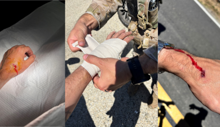 DHS Reports 830% Spike in Assaults on ICE Officers Amid Escalating Anti-Enforcement Sentiment