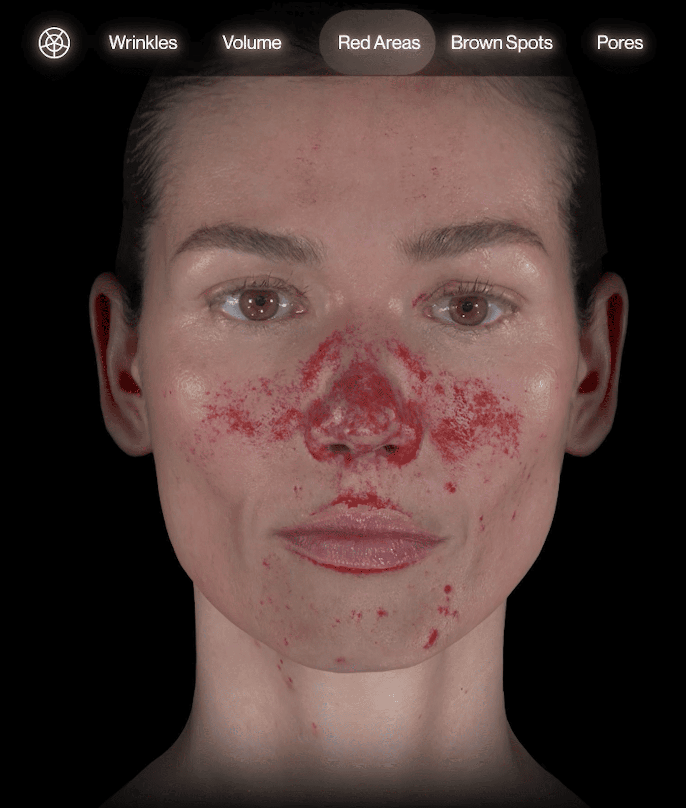 Harta zonelor de roșeață în analiza Aura Skin 3D