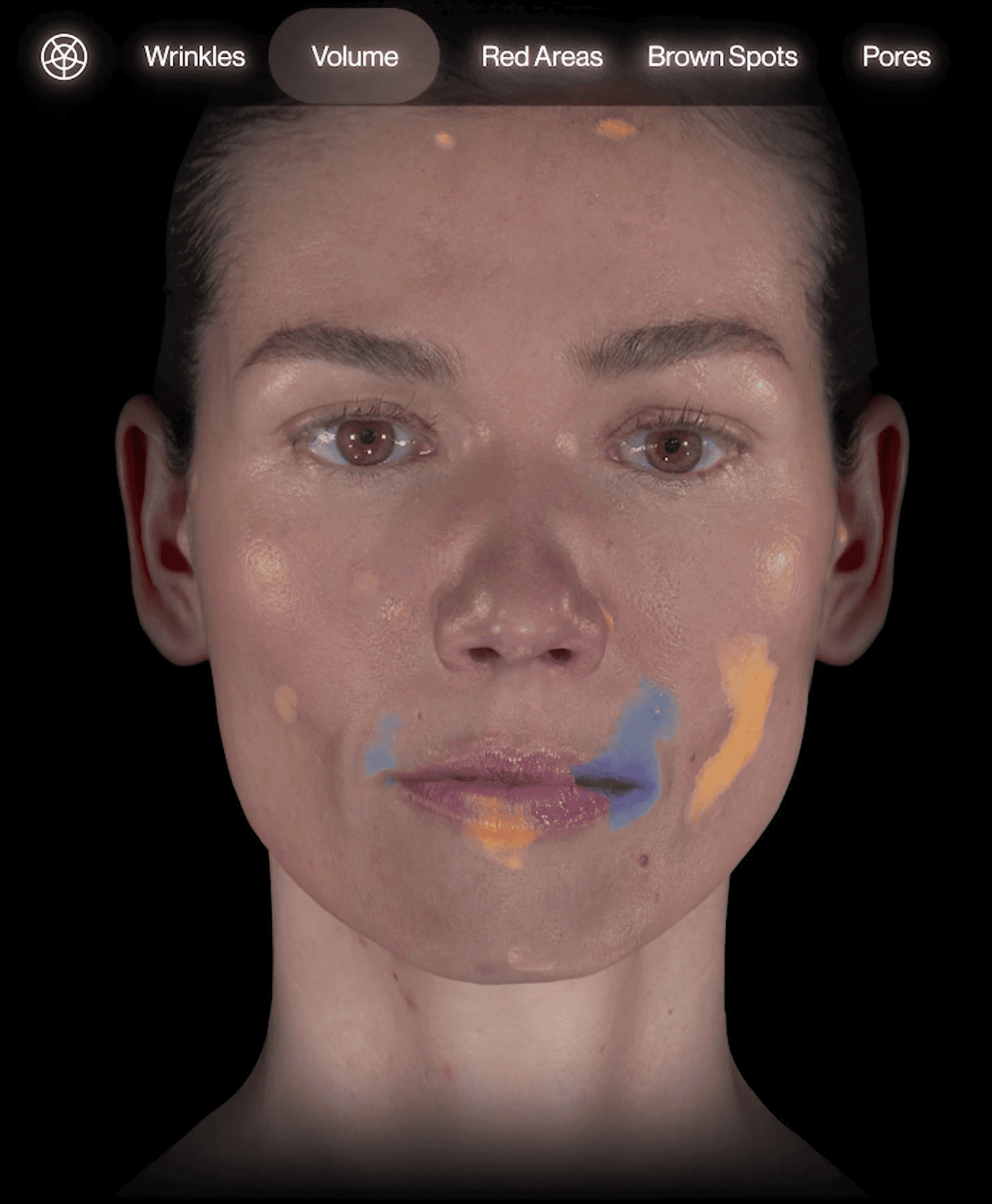 Vizualizarea volumului facial în Aura Skin 3D