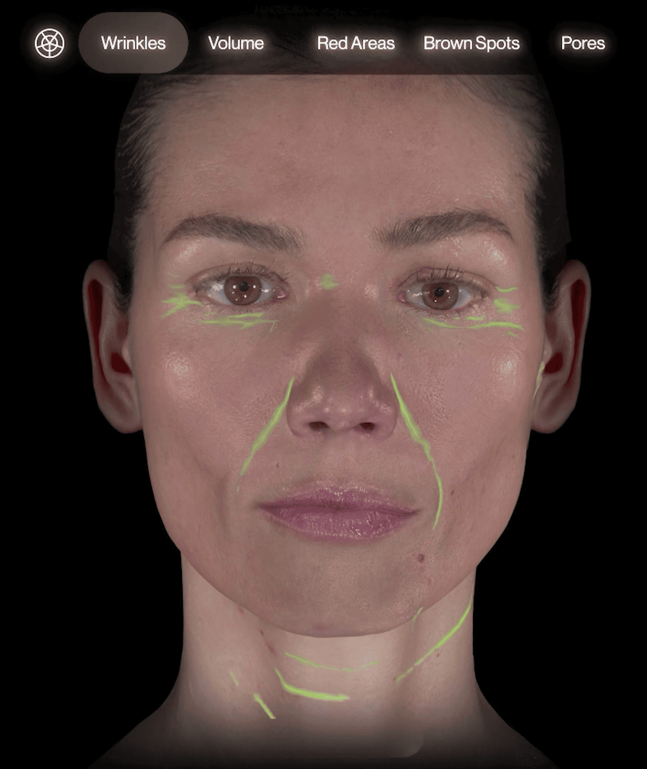 Harta liniilor și ridurilor în analiza Aura Skin 3D