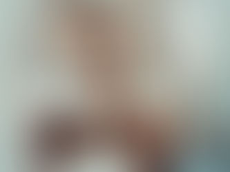 The boy with Heterochromia