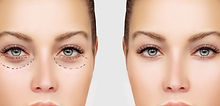 Before and After Surgery