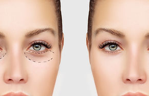 Before and After Surgery