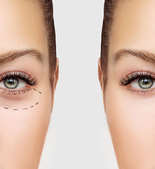 Before and After Surgery