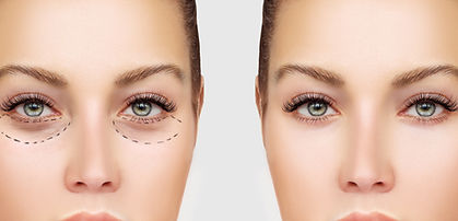 Before and After Surgery